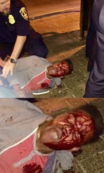 martese johnson bleeding profusely after confrontation with officers